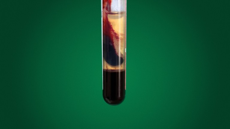  Muestra de sangre normal